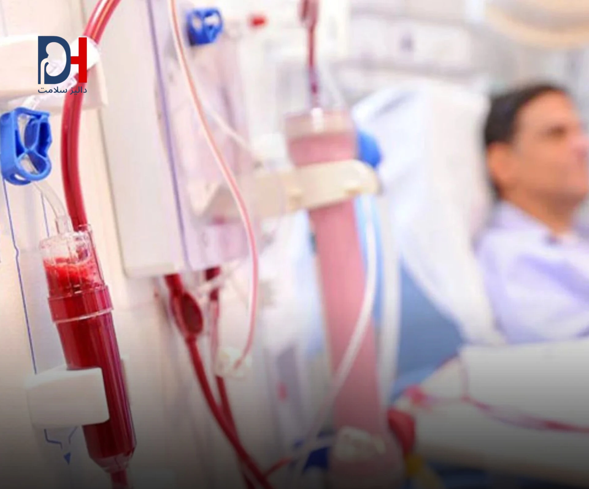 دیالیز رایگان