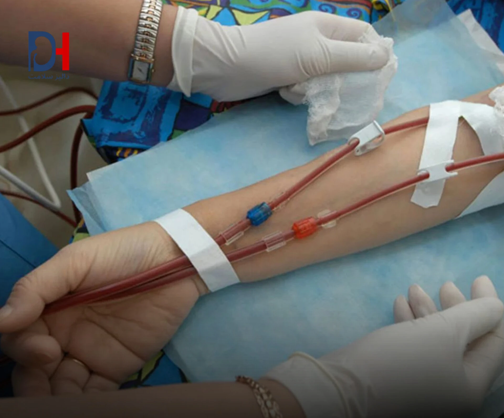 دیالیز رایگان