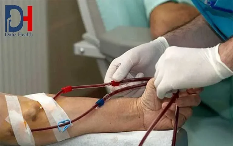 دیالیز رایگان