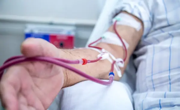 تفاوت تغذیه در دیالیز خونی و دیالیز صفاقی